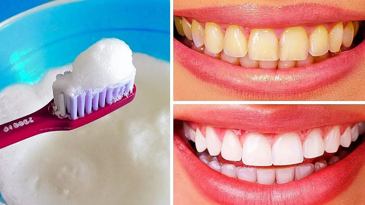 12 Tips to Effectively Whiten Yellow Teeth