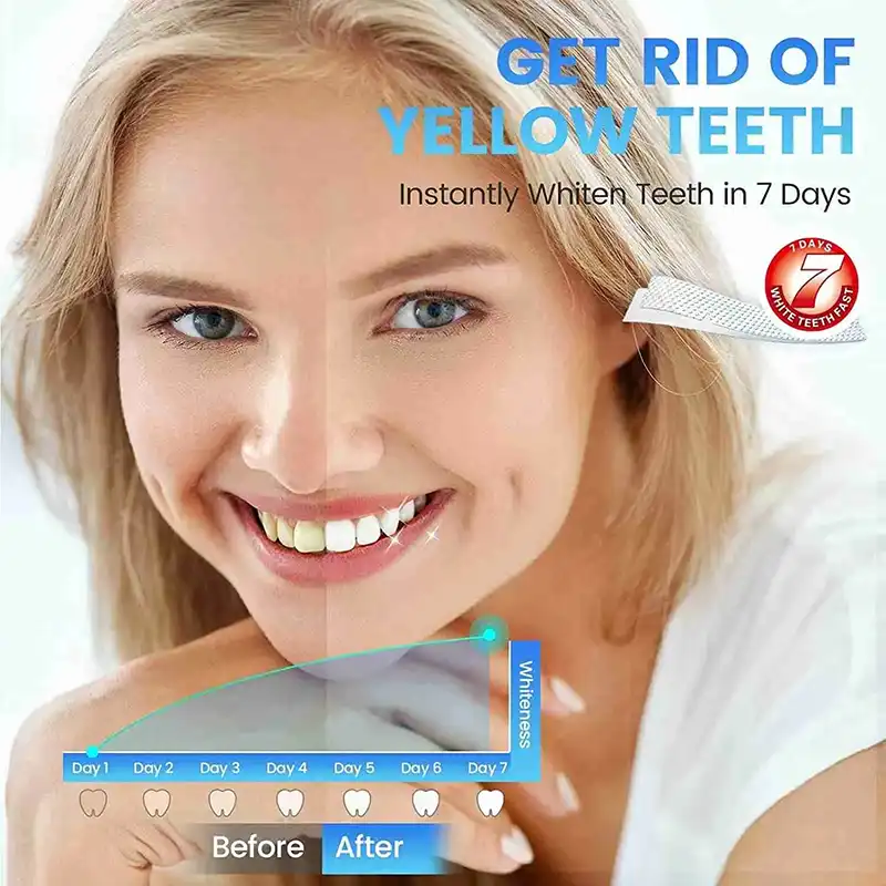 5D Teeth Whitening Strips (7)