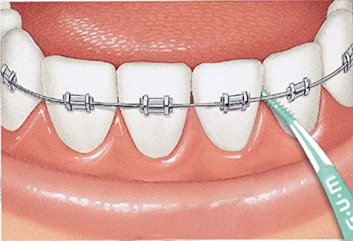 Advanced Dental Picks (3)