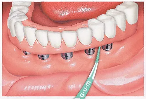 Advanced Dental Picks (4)