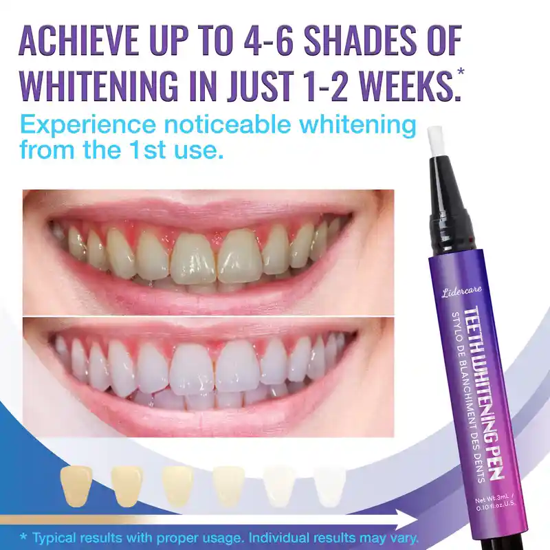 Carbamide Peroxide Whitening Pen Gel (3)