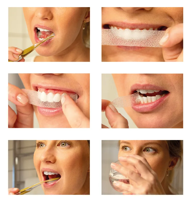 Verfallen Whitening Strips