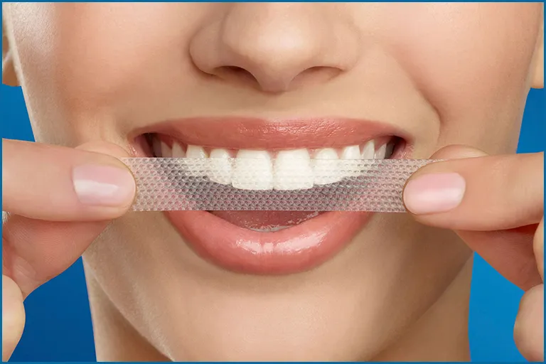 Do Whitening Strips Expire