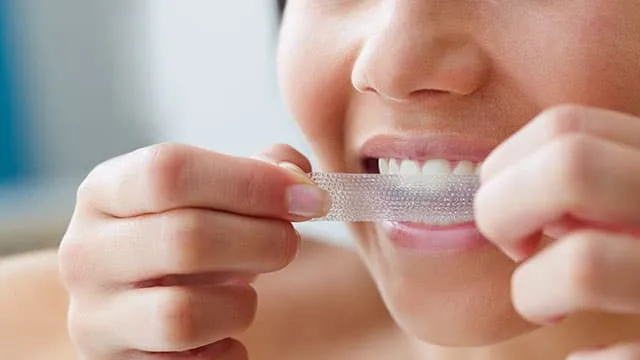 Expired Teeth Whitening Strips