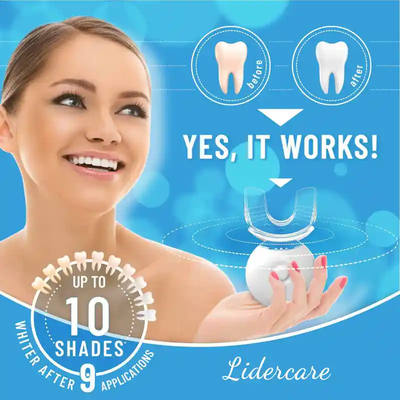 Fast Teeth Whitening Kit (2)