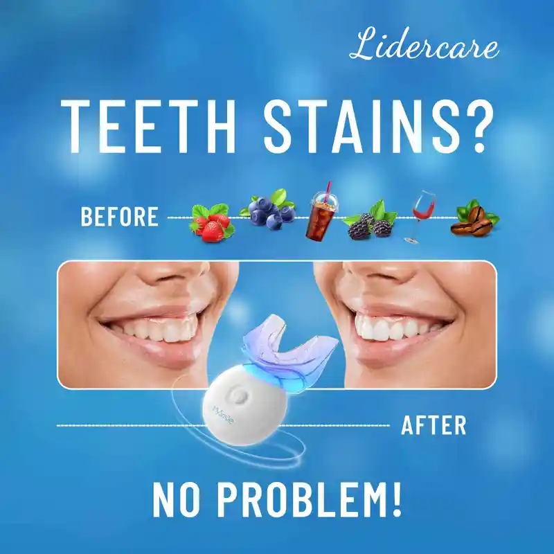 Fast Teeth Whitening Kit (5)