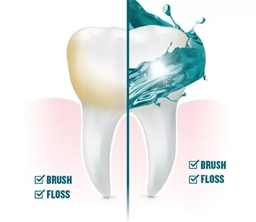 Nước súc miệng hoạt động như thế nào