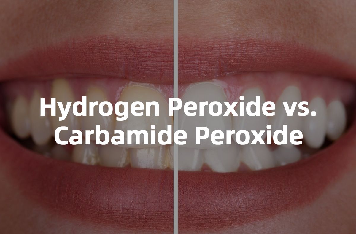 Hidrogen Peroksida vs Karbamid Peroksida
