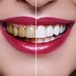 Intense Whitening