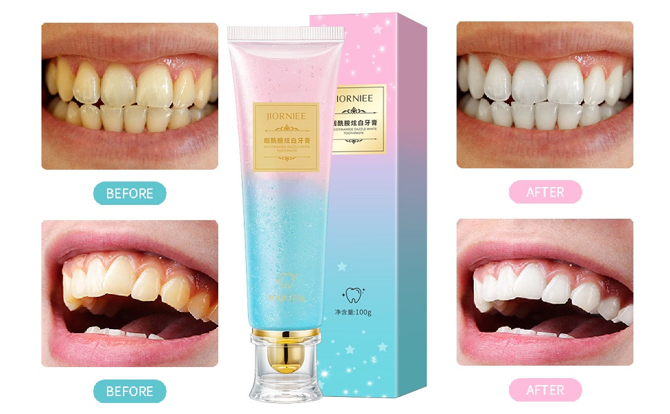 Is Niacinamide the Next Big Thing in Teeth Whitening
