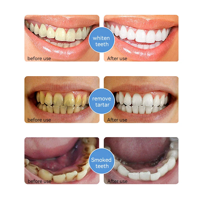 Nano Hydroxyapatite Toothpaste (6)