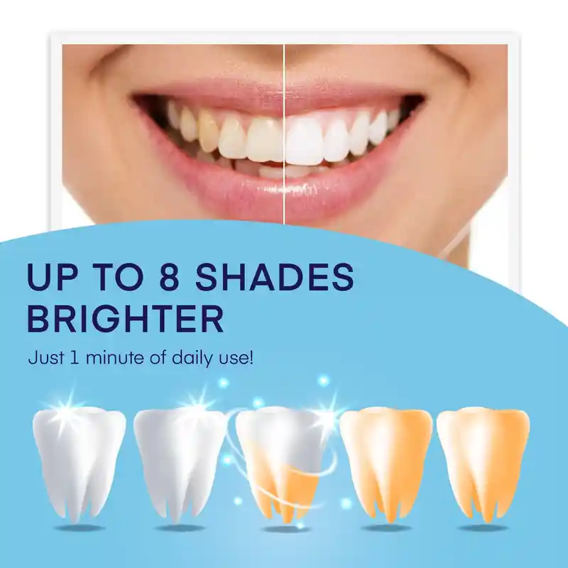 No Sensitivity Teeth Whitening Pen (2)
