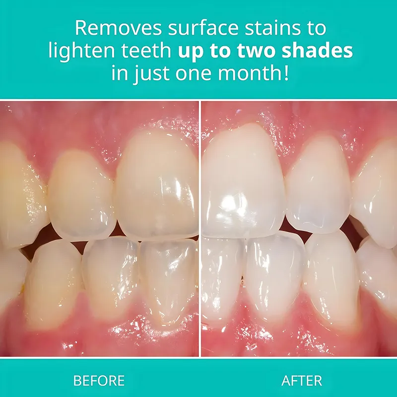 Original Whitening Toothpaste (4)