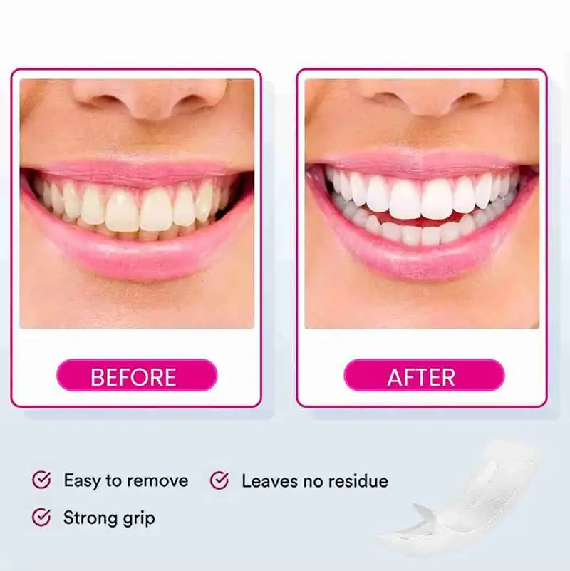 Pap+ Teeth whitening Strips (2)