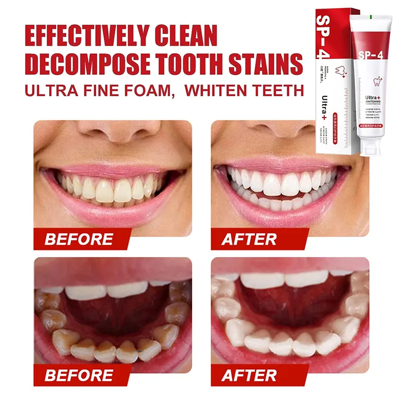 Probiotic Whitening Toothpaste (4)