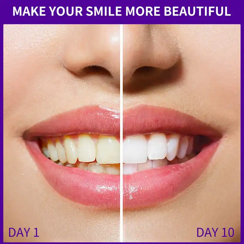 Purple Teeth Whitening Foam (5)