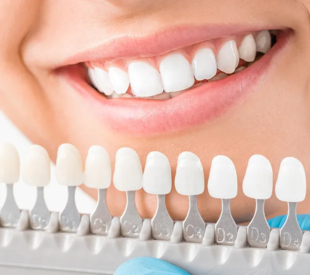Criar o teu negócio de branqueamento dentário