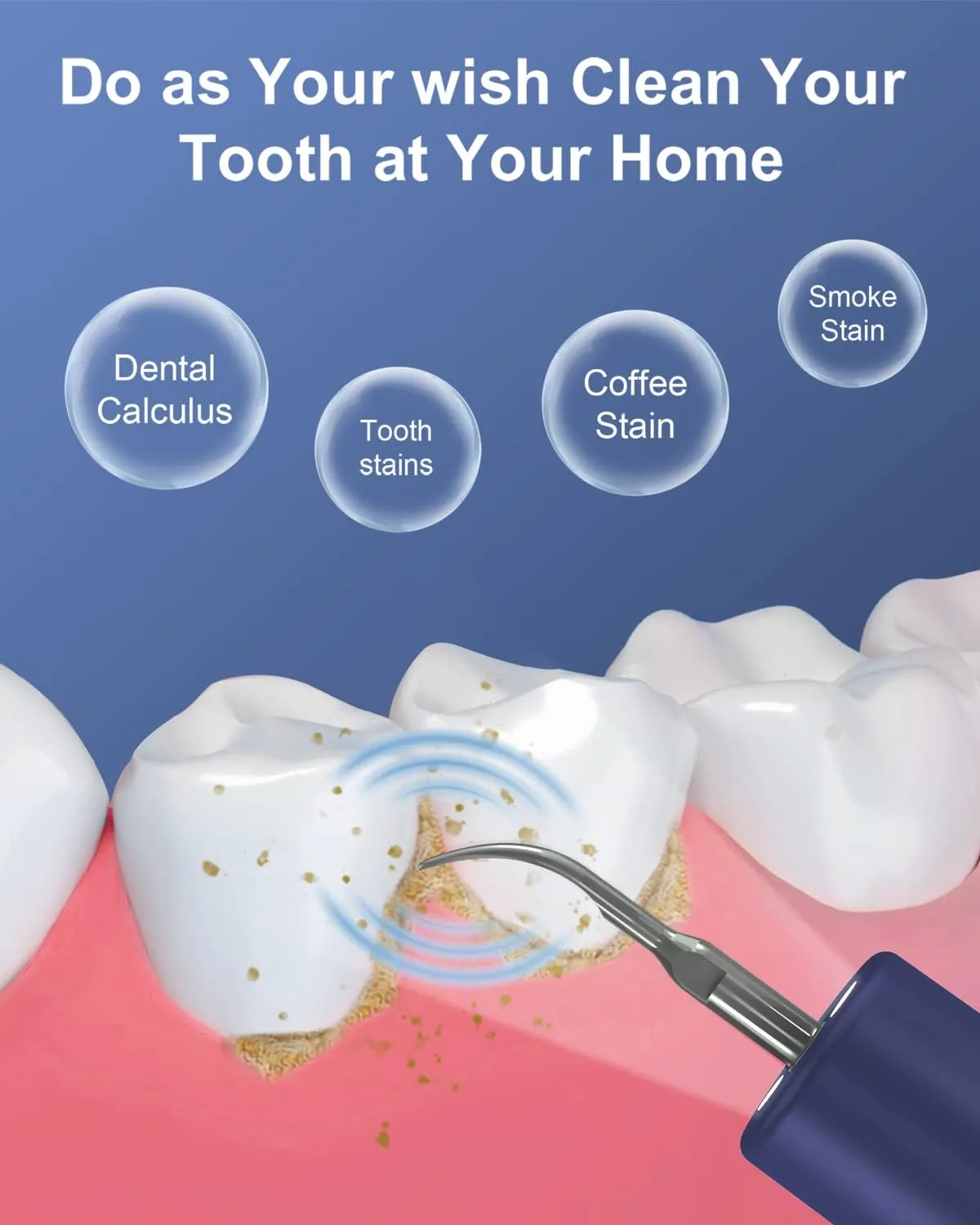 Tartar Remover for Teeth (2)