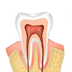 Teeth anti-sensitivity