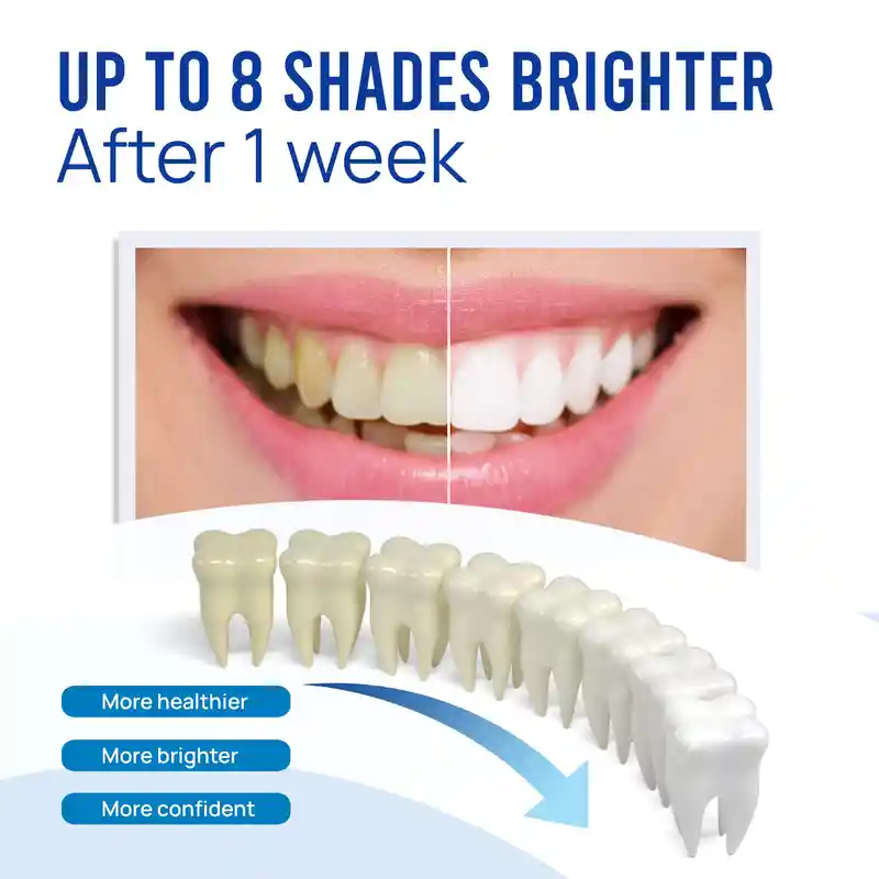 Travel-Friendly Teeth Whitening Pen (4)