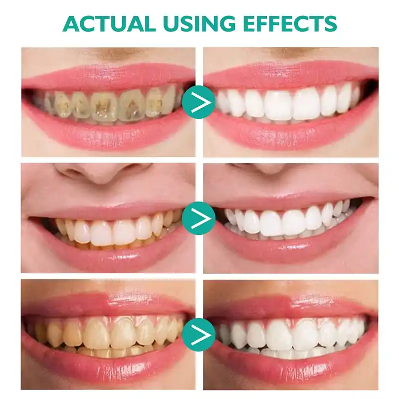 Ultra-fine Foam Deeply Cleaning Gums (3)